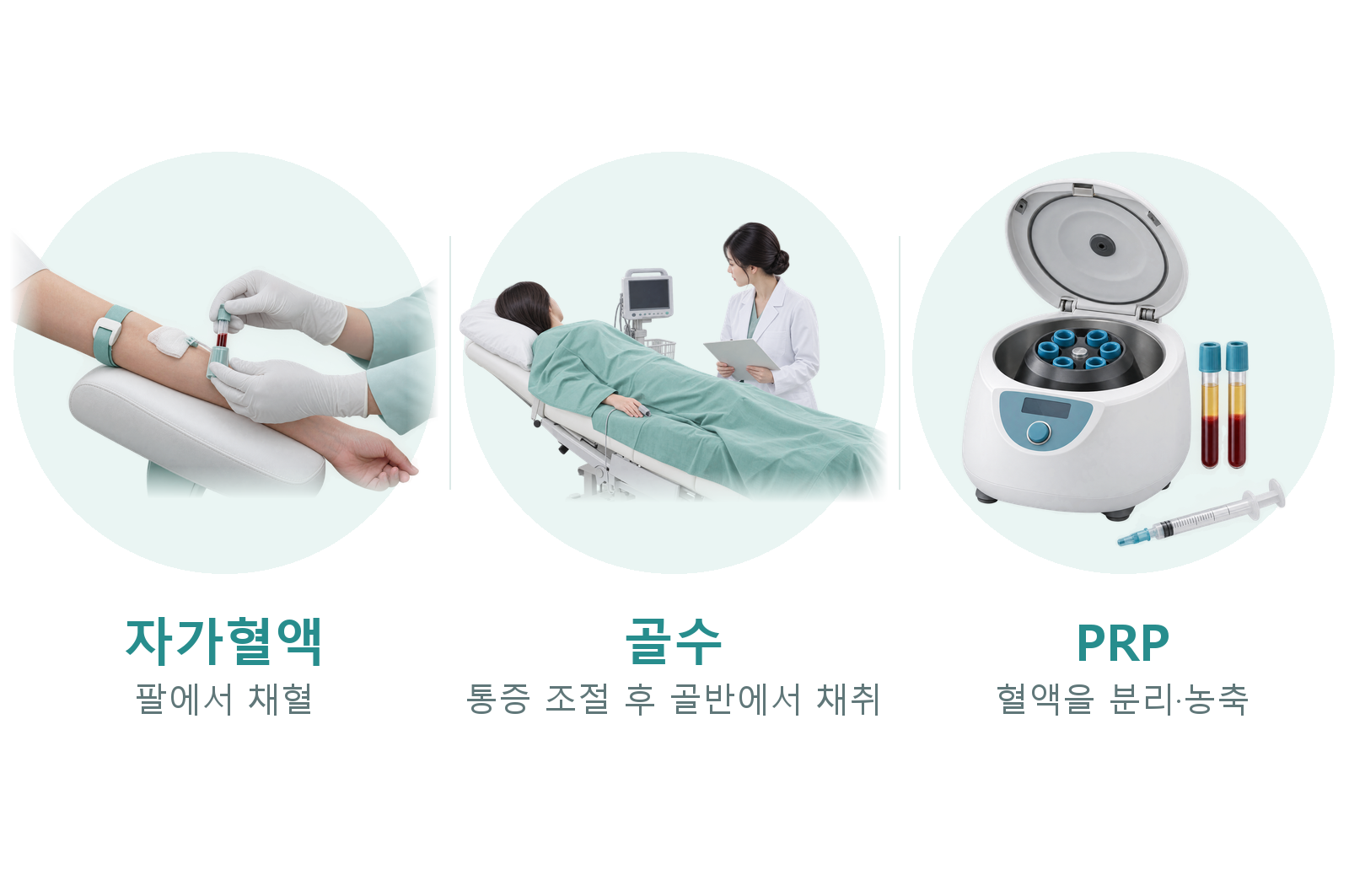 자가혈액·골수·PRP 비교: 팔에서 채혈하는 자가혈액, 통증 조절 후 골반에서 채취하는 골수, 혈액을 분리·농축한 PRP